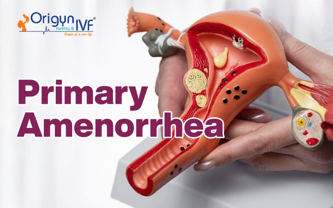 Primary Amenorrhea: Pathophysiology, Causes, and Impact on Health