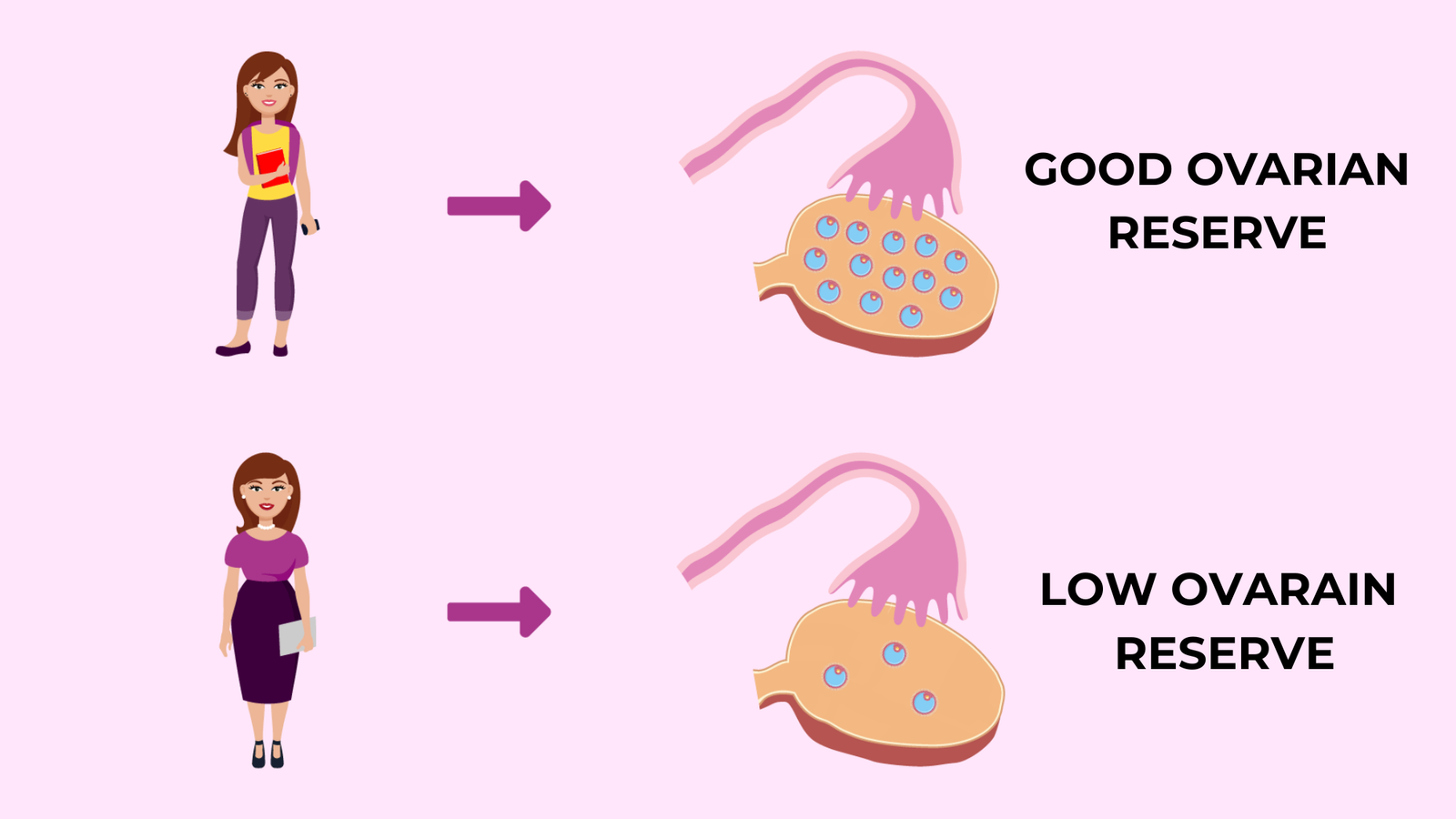 Antral Follicle Count