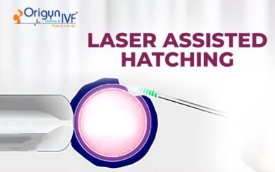 Laser Assisted Hatching: A Complete Guide 2025
