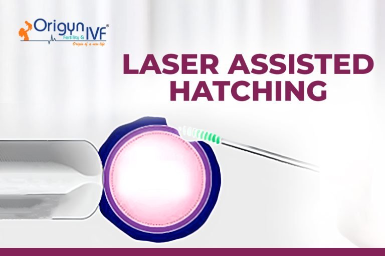 Laser Assisted Hatching