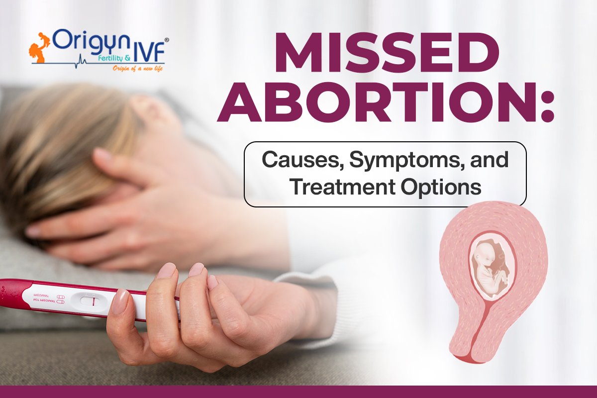 Missed Abortion