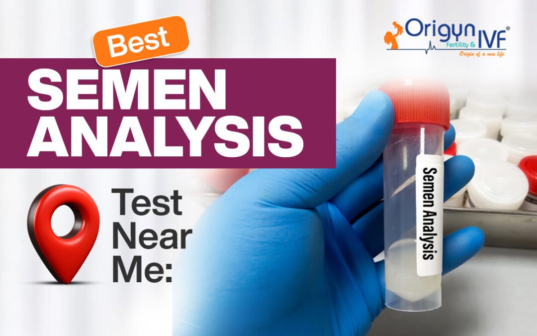 Best Semen Analysis Test Near Me in 2025