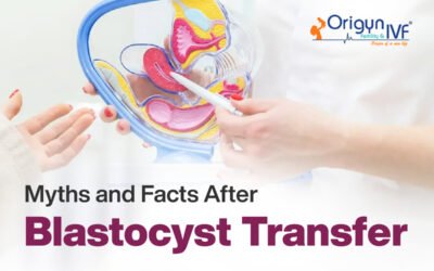 Blastocyst Transfer: 9 Myths and Facts You Must Know