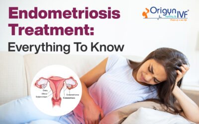 Endometriosis Treatment: The Complete Guide for 2025