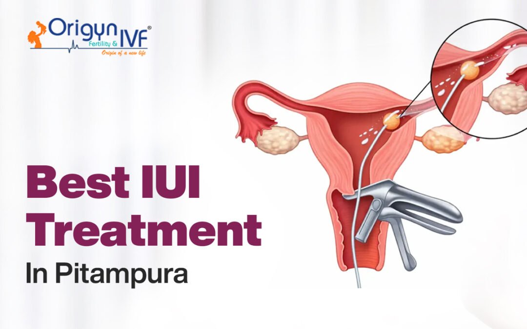 Best IUI Treatment in Pitampura, 2026
