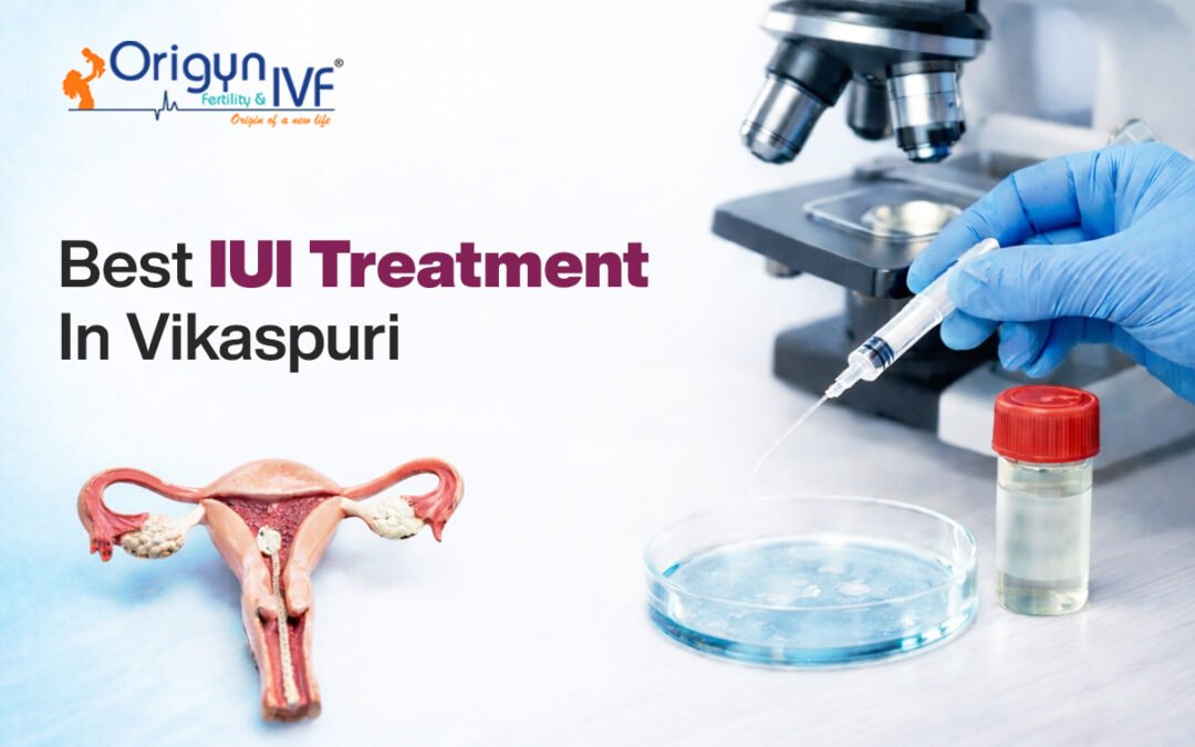 Best IUI Treatment in Vikaspuri: Complete Guide