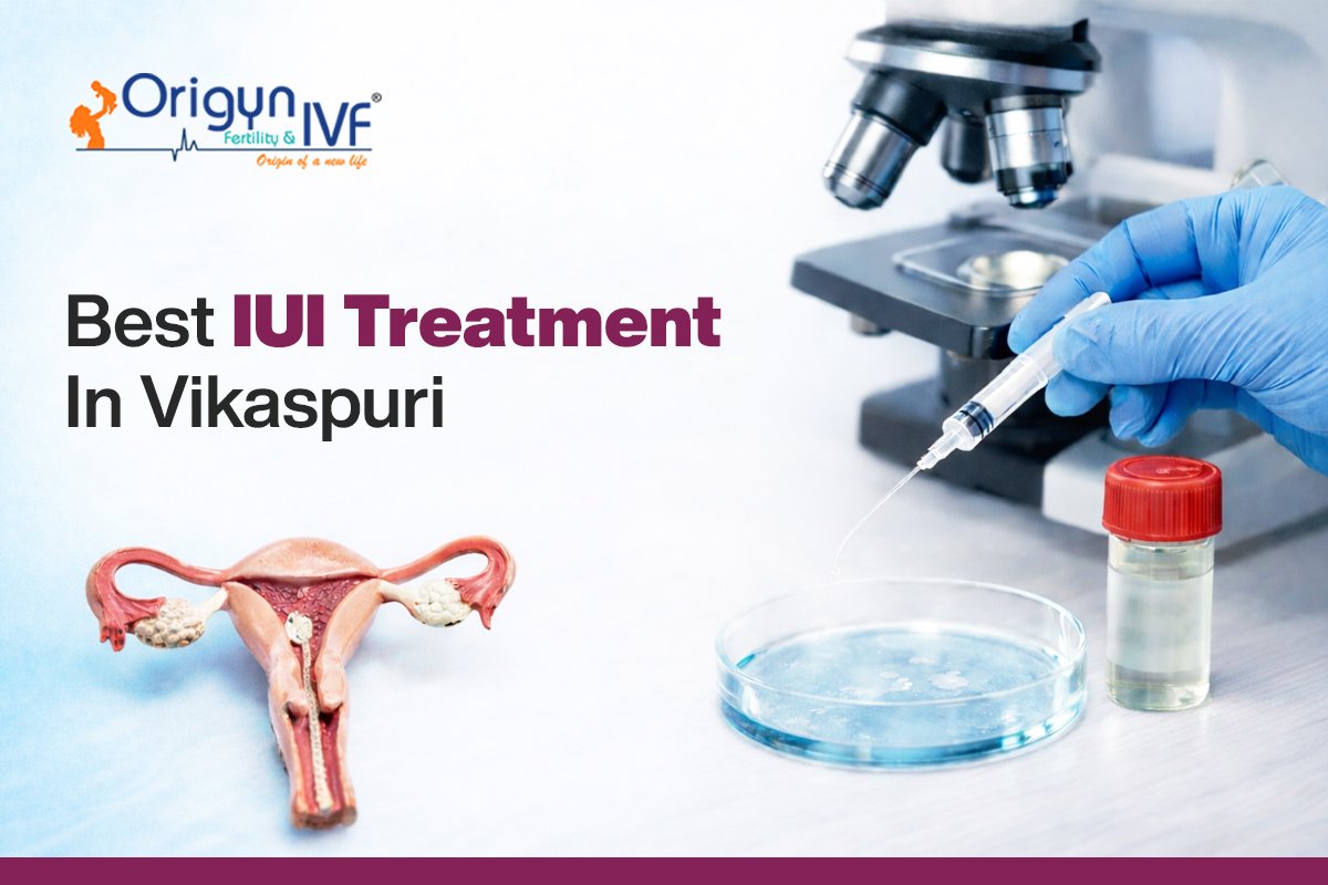 Best IUI Treatment in Vikaspuri