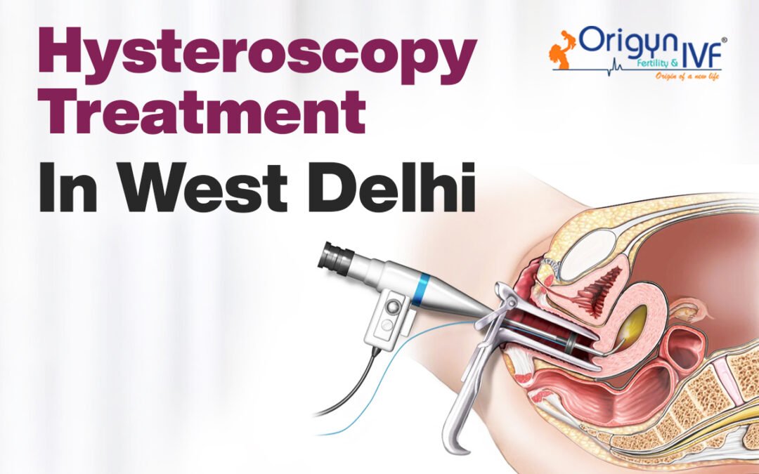 hysteroscopy treatment in west delhi