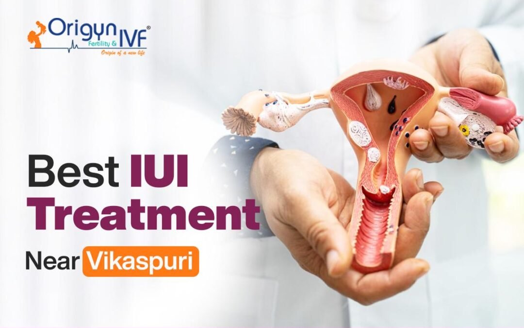 Best IUI treatment near Vikaspuri